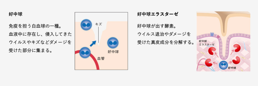 ニールセン1